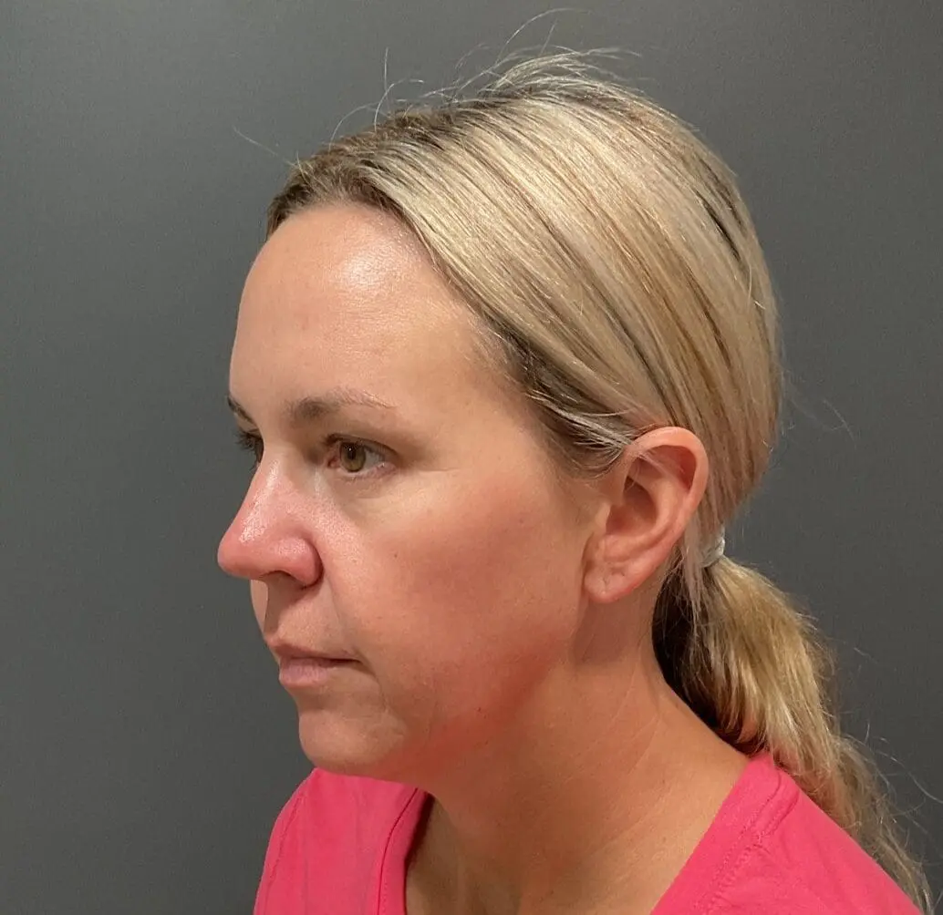 IMG 2397 e1747939326376 | Naturally You Medical Spa