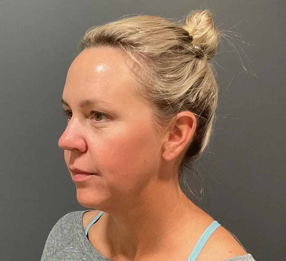 IMG 2780 e1747939364481 | Naturally You Medical Spa