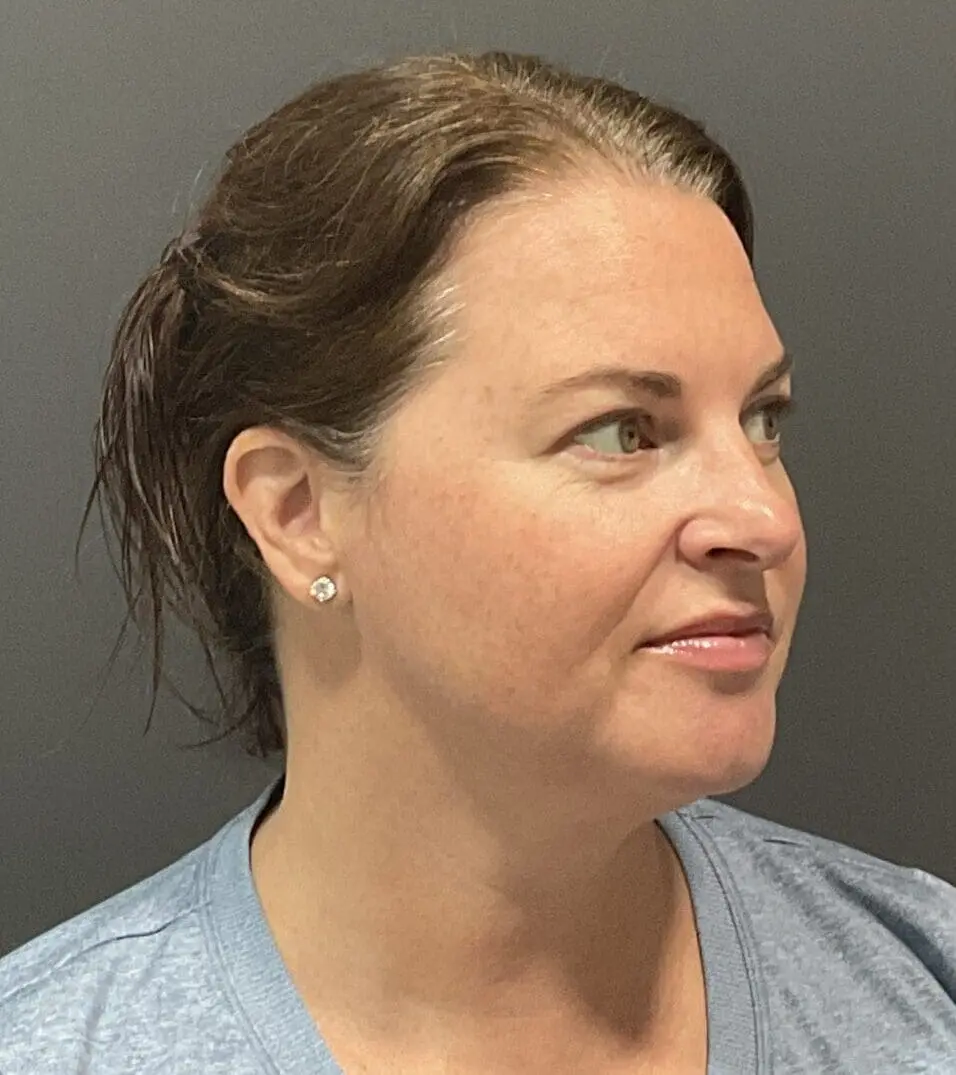 IMG 7976 scaled e1745426751594 | Naturally You Medical Spa