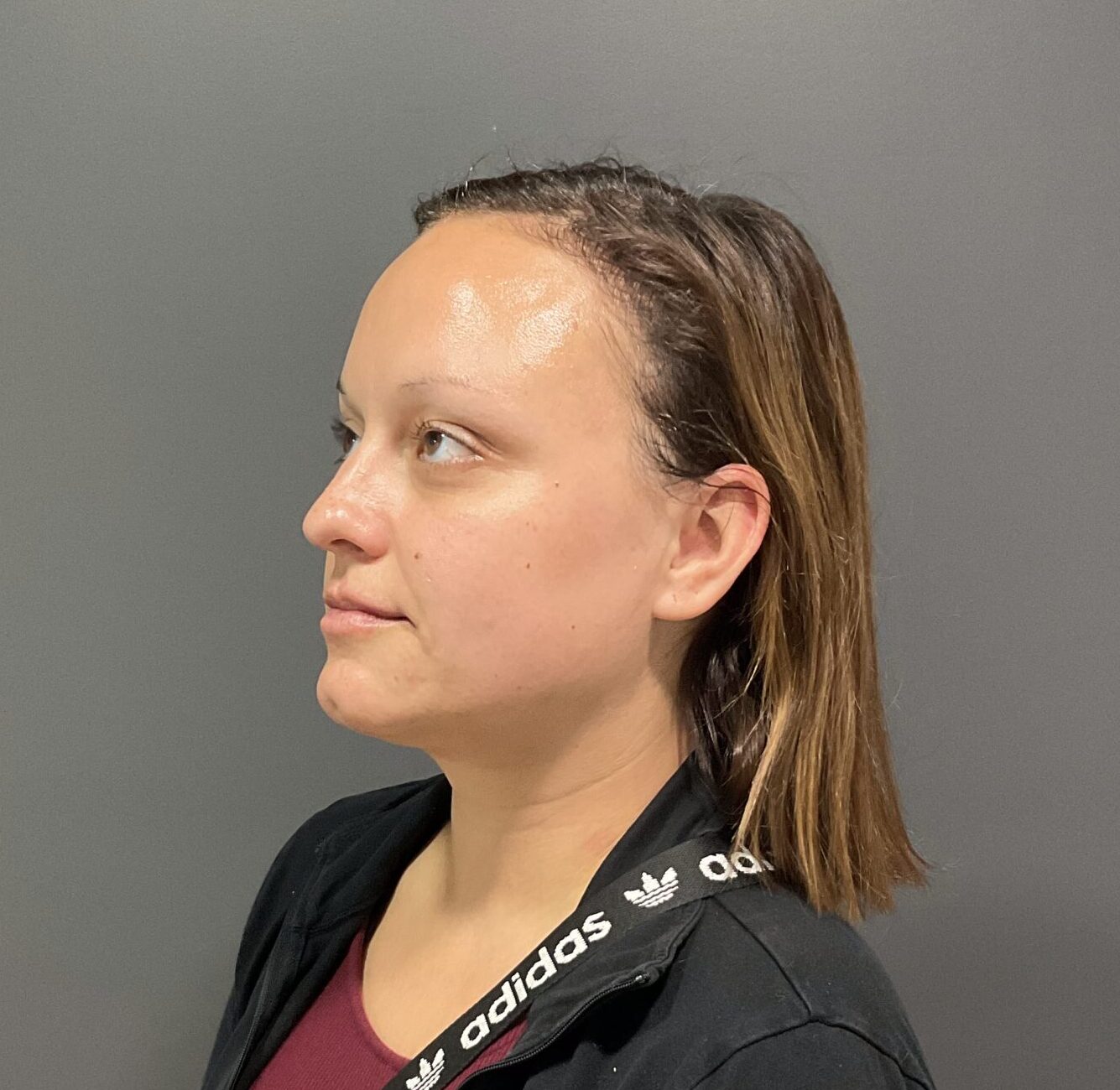 IMG 1371 scaled e1747935092196 | Naturally You Medical Spa