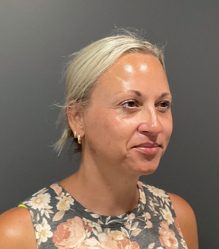 IMG 6984 scaled e1747939957443 | Naturally You Medical Spa