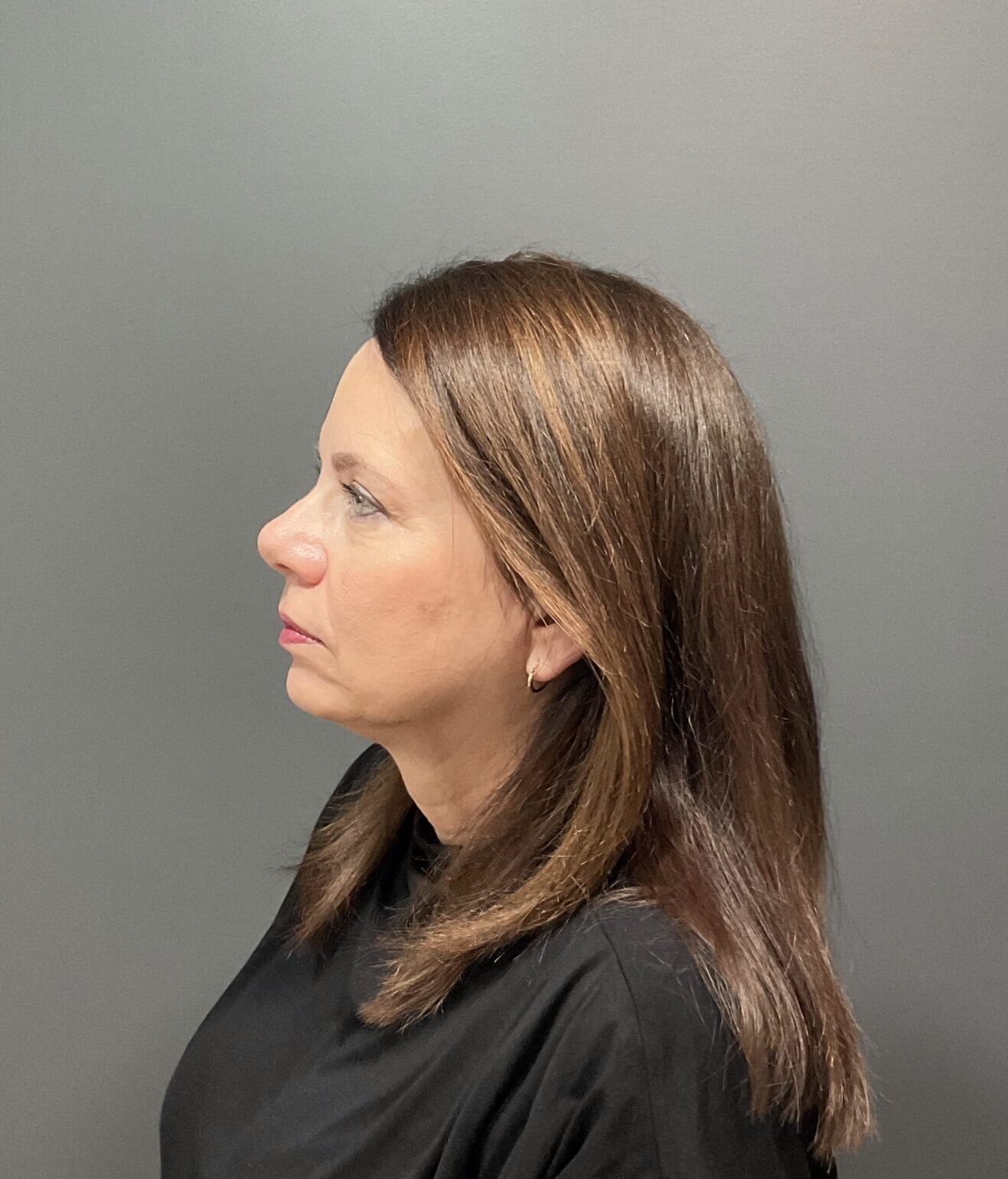 IMG 8991 scaled e1747769921875 | Naturally You Medical Spa