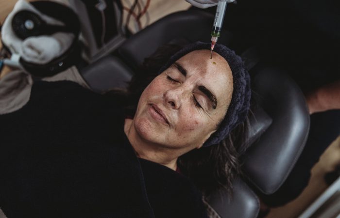 chemical-peels-vs-hydrafacial-which-is-best-for-spring-skin-renewal-1-1