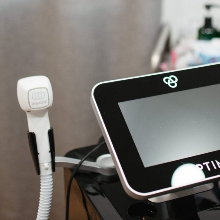 An Optimas machine with a handpiece used for laser treatments in a medical spa.